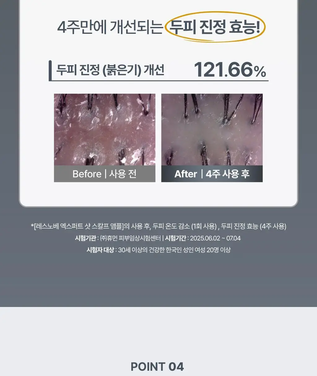 [탈모예방 특허성분] 레스노베 엑스퍼트 샷 스칼프 앰플 15ml (3개입) 상세페이지 24